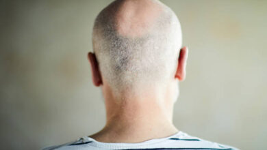 istockphoto 1039505084 612x612 1 İnsult keçirən azərbaycanlı məşhurun son halı ürək dağladı - VİDEO