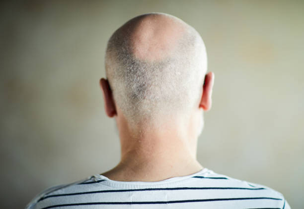İnsult keçirən azərbaycanlı məşhurun son halı ürək dağladı - VİDEO 1 istockphoto 1039505084 612x612 1 İnsult keçirən azərbaycanlı məşhurun son halı ürək dağladı - VİDEO